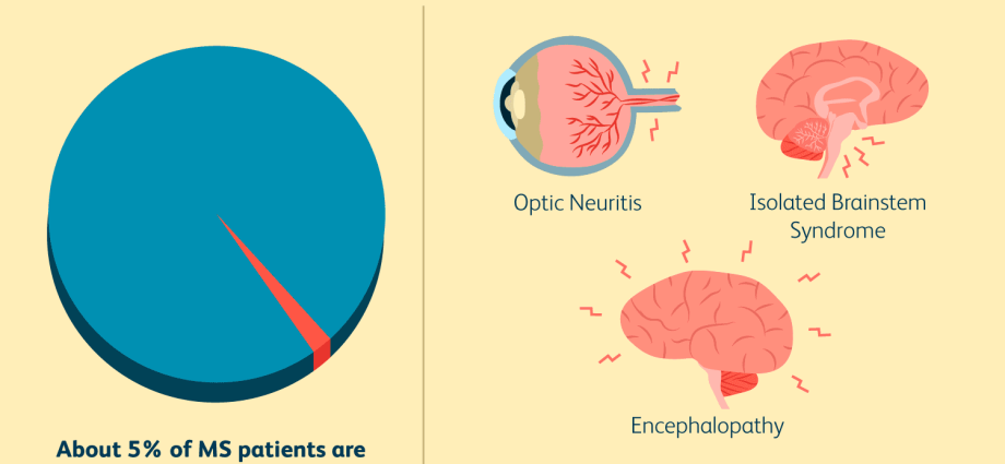 Multiple sclerosis in children