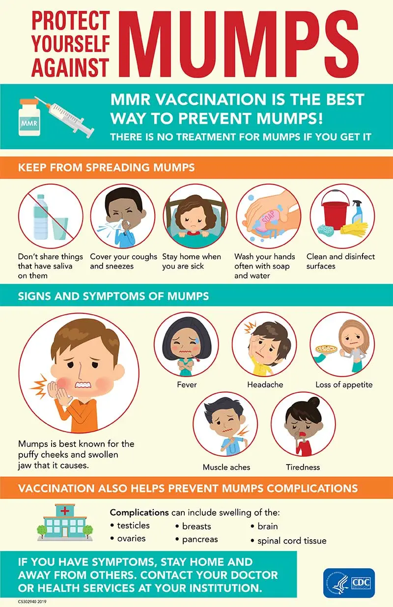 Mumps &#8211; causes, symptoms, treatment, complications. Mumps vaccines