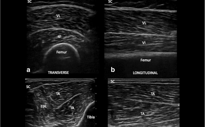 Muscle ultrasound &#8211; when to perform and what does the examination look like?