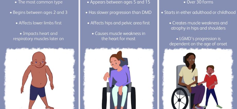 Muscular dystrophy &#8211; types, treatment