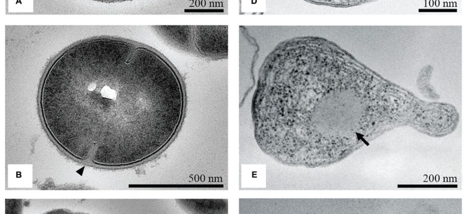 Mushroom extracts inhibit the development of staphylococcus