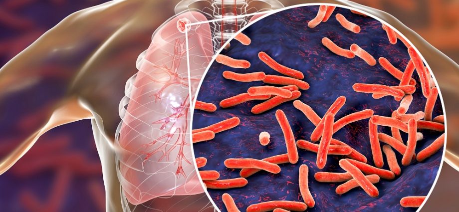 Mycobacteria strike back. Tuberculosis more dangerous than ever?