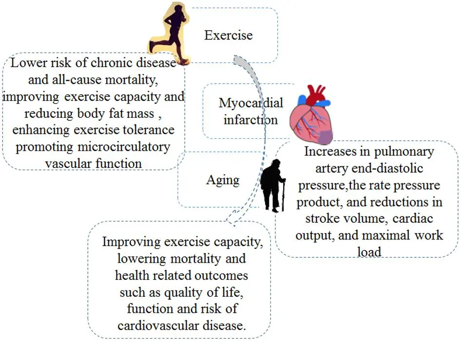 Myocardial infarction in a senior. Prevention and help for the elderly [EXPLAIN]