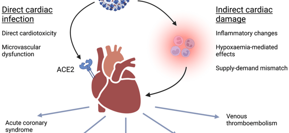 Myocarditis. The worst complication after COVID-19 also affects the young and healthy