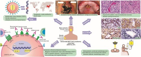 Nasal lymphoma from T / NK cells