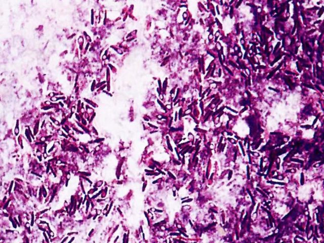 Necrobacteriosis in cattle: treatment and prevention