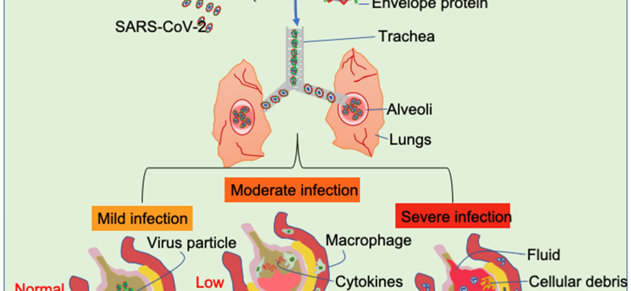 Neoplastic changes in the respiratory system