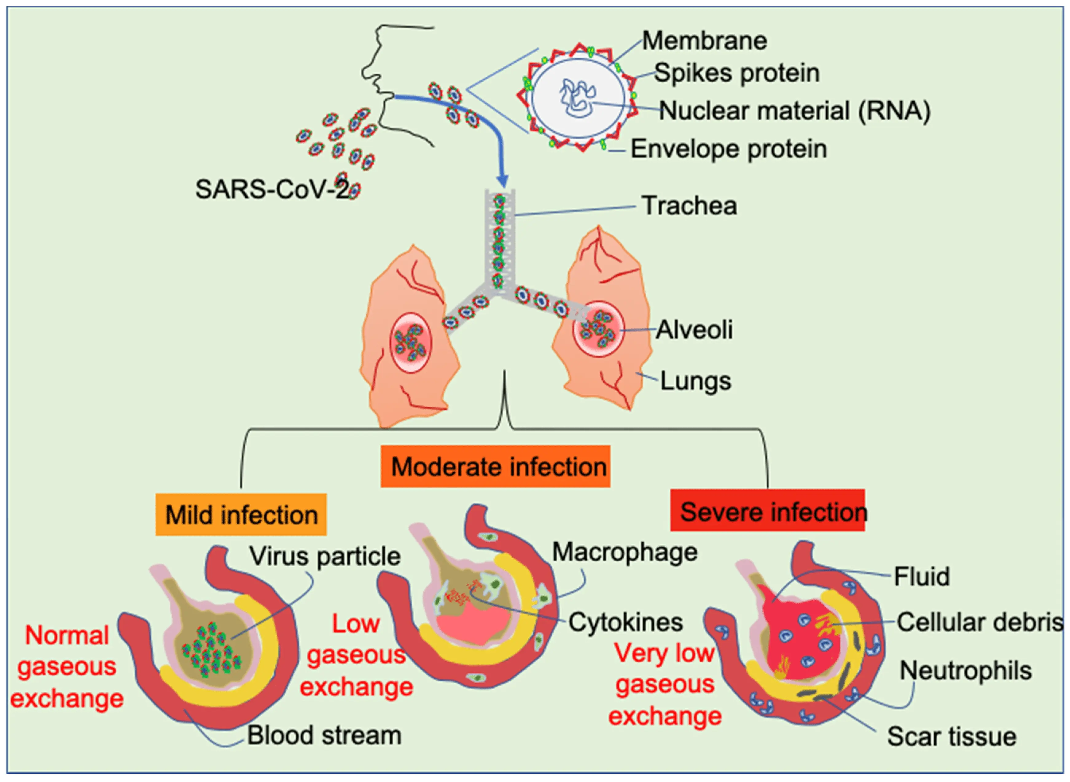 Neoplastic changes in the respiratory system