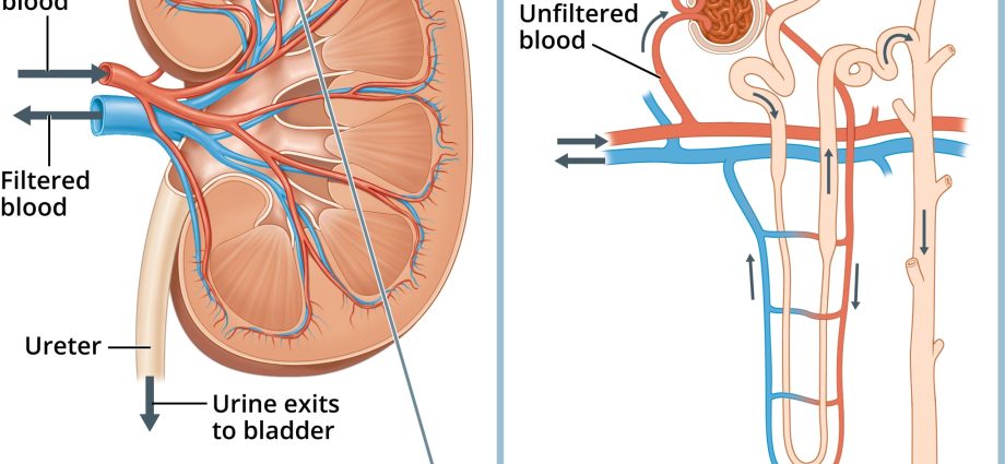 Nephrotic syndrome