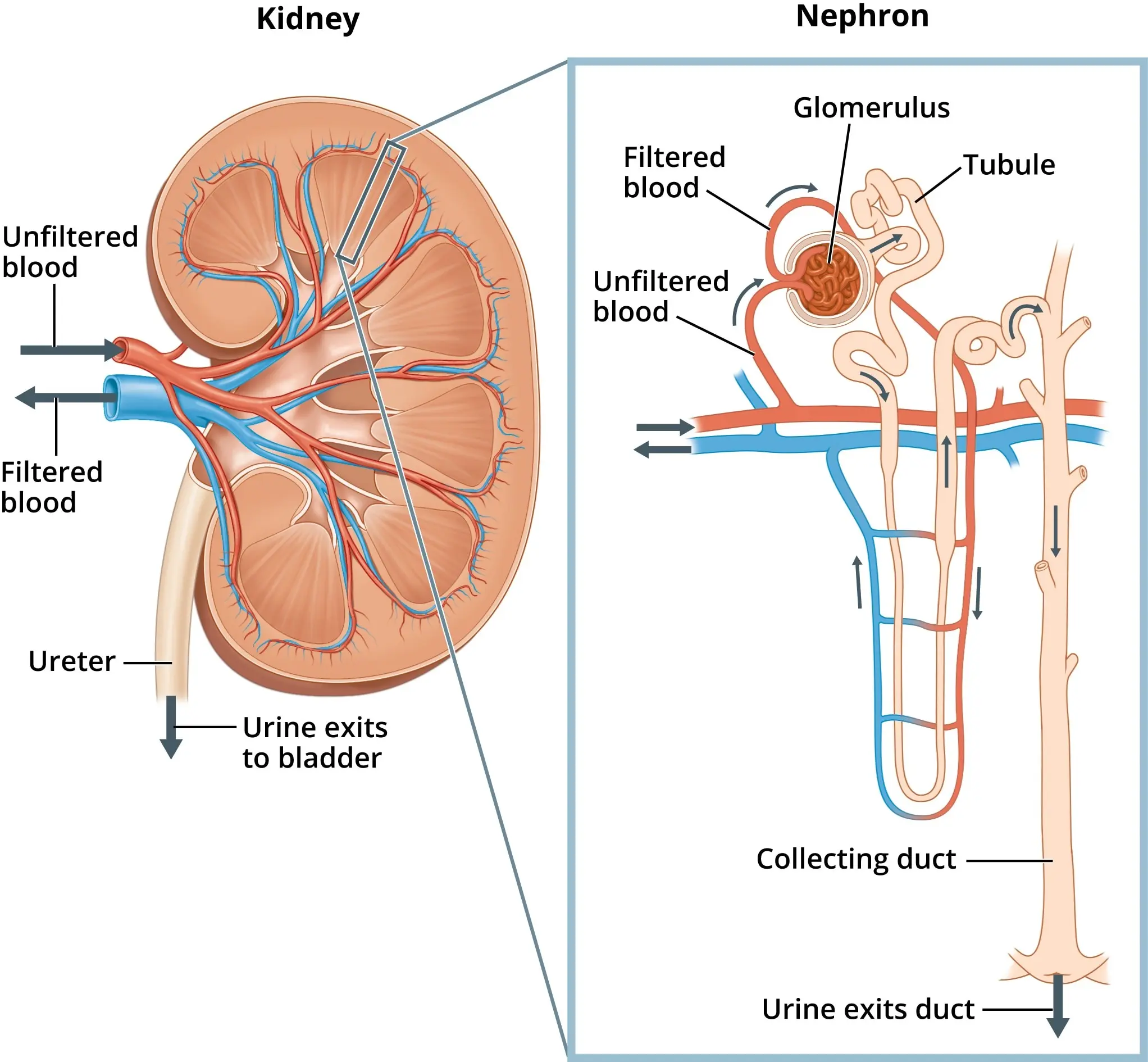 Nephrotic syndrome