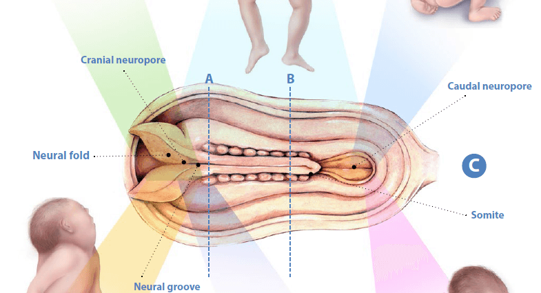 Nerve urethral failure &#8211; a congenital malformation