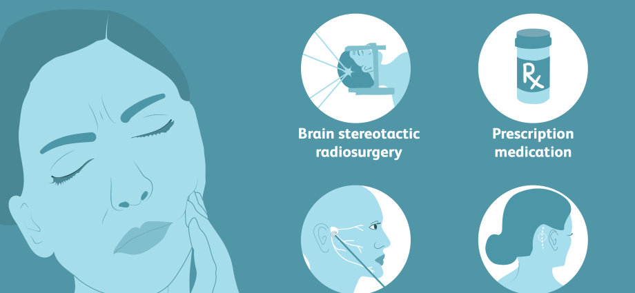 Neuralgia &#8211; types, symptoms, diagnosis and treatment of neuralgia