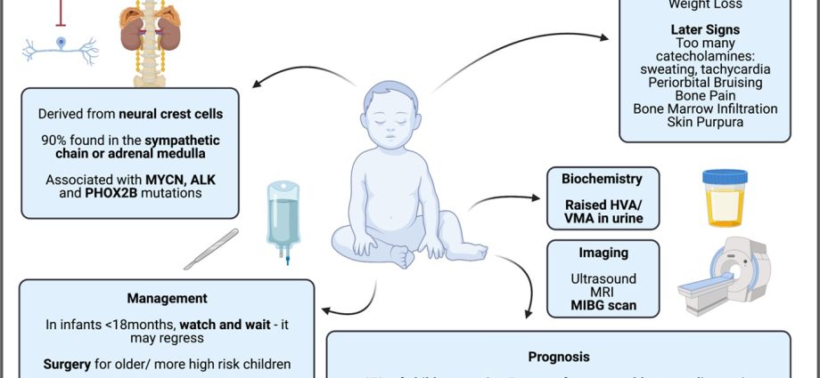 Neuroblastoma in children &#8211; causes, symptoms, diagnosis, treatment