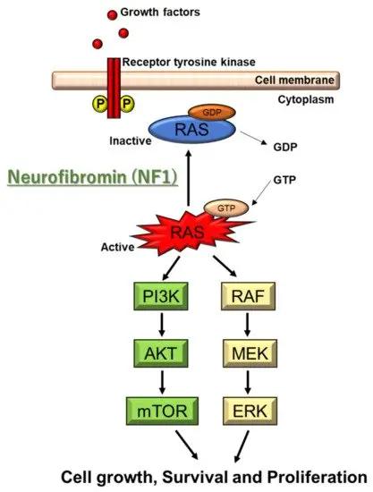 Neurofibromatosis &#8211; deforming genetic disease. Diagnostics and treatment