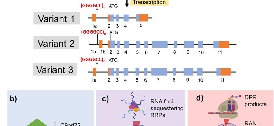 New mutations responsible for amyotrophic lateral sclerosis have been discovered