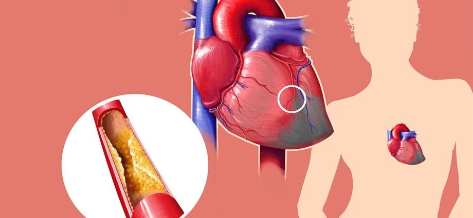 Nine surprising facts about cholesterol. Some will run for tests