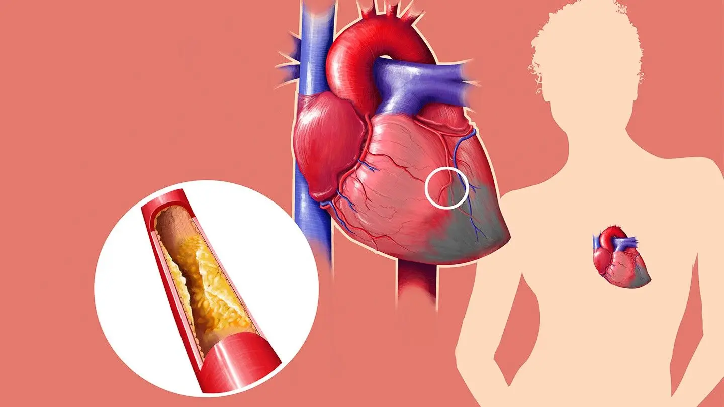 Nine surprising facts about cholesterol. Some will run for tests