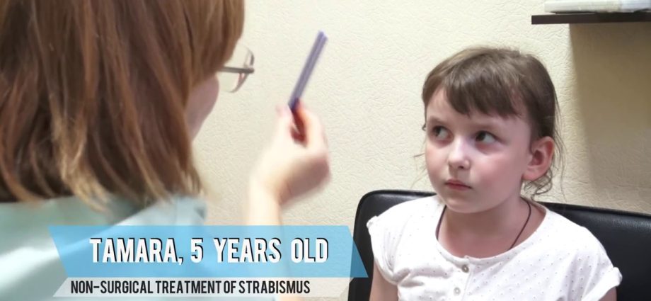 Non-operative treatment of strabismus in children