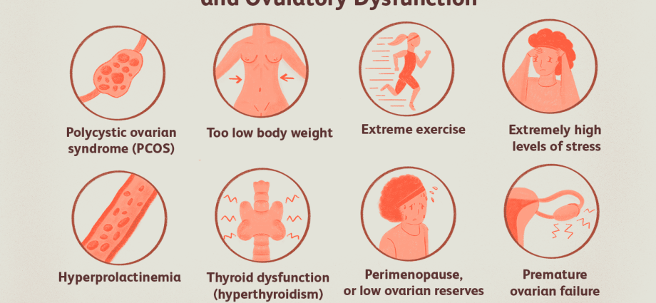 Non-ovulatory cycles and hormone therapy. The causes of anovulation