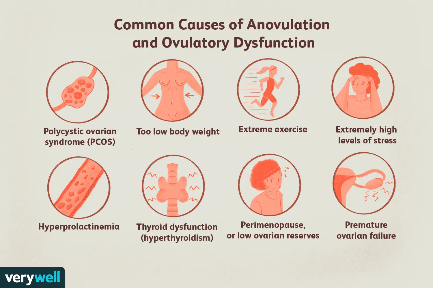 Non-ovulatory cycles and hormone therapy. The causes of anovulation