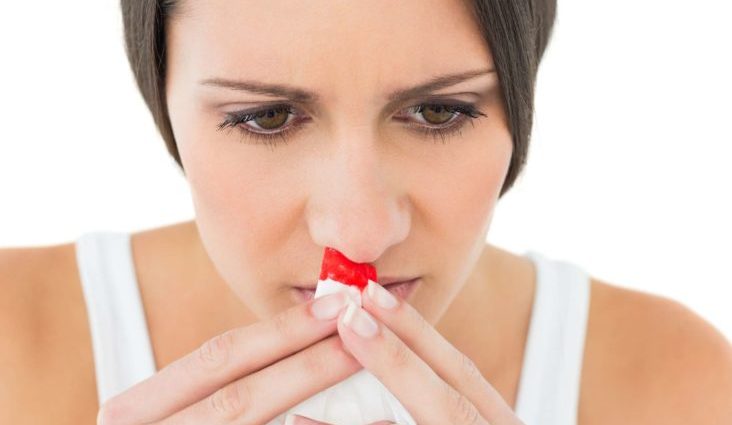 Nose bleeding &#8211; a banal ailment? Not necessarily