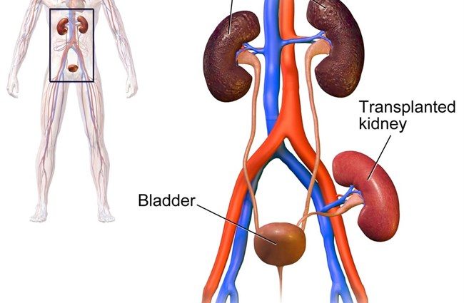 Now you can transplant a kidney from any person