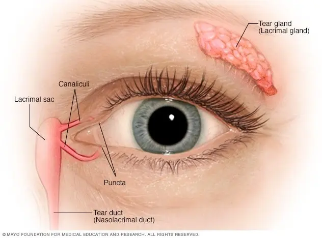 Obstruction of the tear duct &#8211; causes, symptoms, diagnosis and treatment