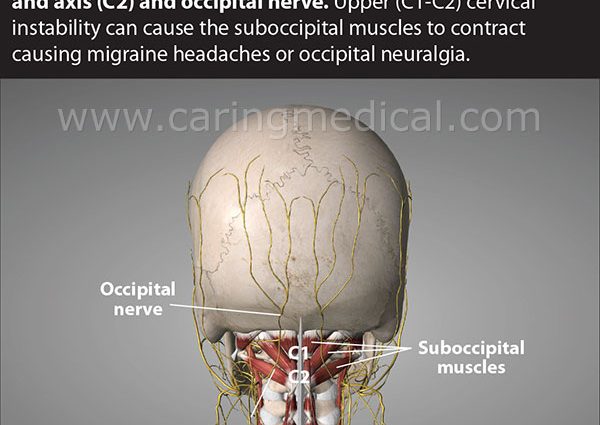 Occipital &#8211; structure, pain in the back of the head, causes of disorders