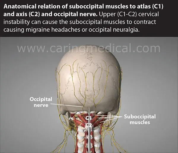 Occipital &#8211; structure, pain in the back of the head, causes of disorders