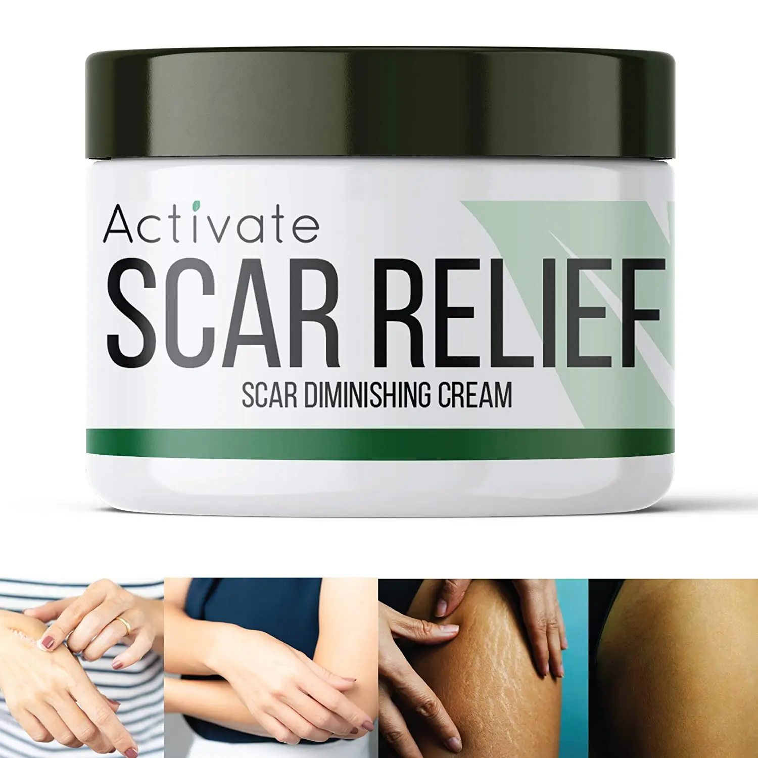 Ointment for scars &#8211; types. Ointment for acne and postoperative scars