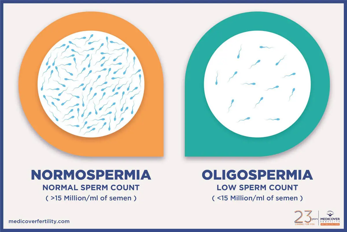 Oligospermia &#8211; definition, causes, diagnosis, treatment of reduced sperm count in semen