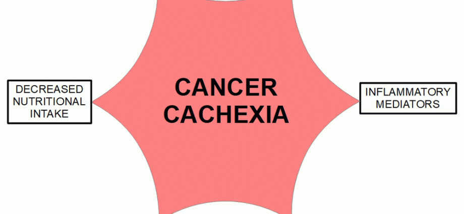 One in five cancer patients dies of cachexia