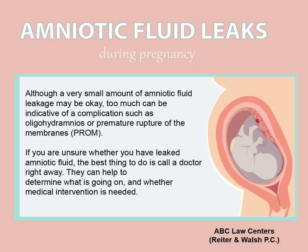 Oozing amniotic fluid &#8211; symptoms and causes. Amniotic fluid drainage test