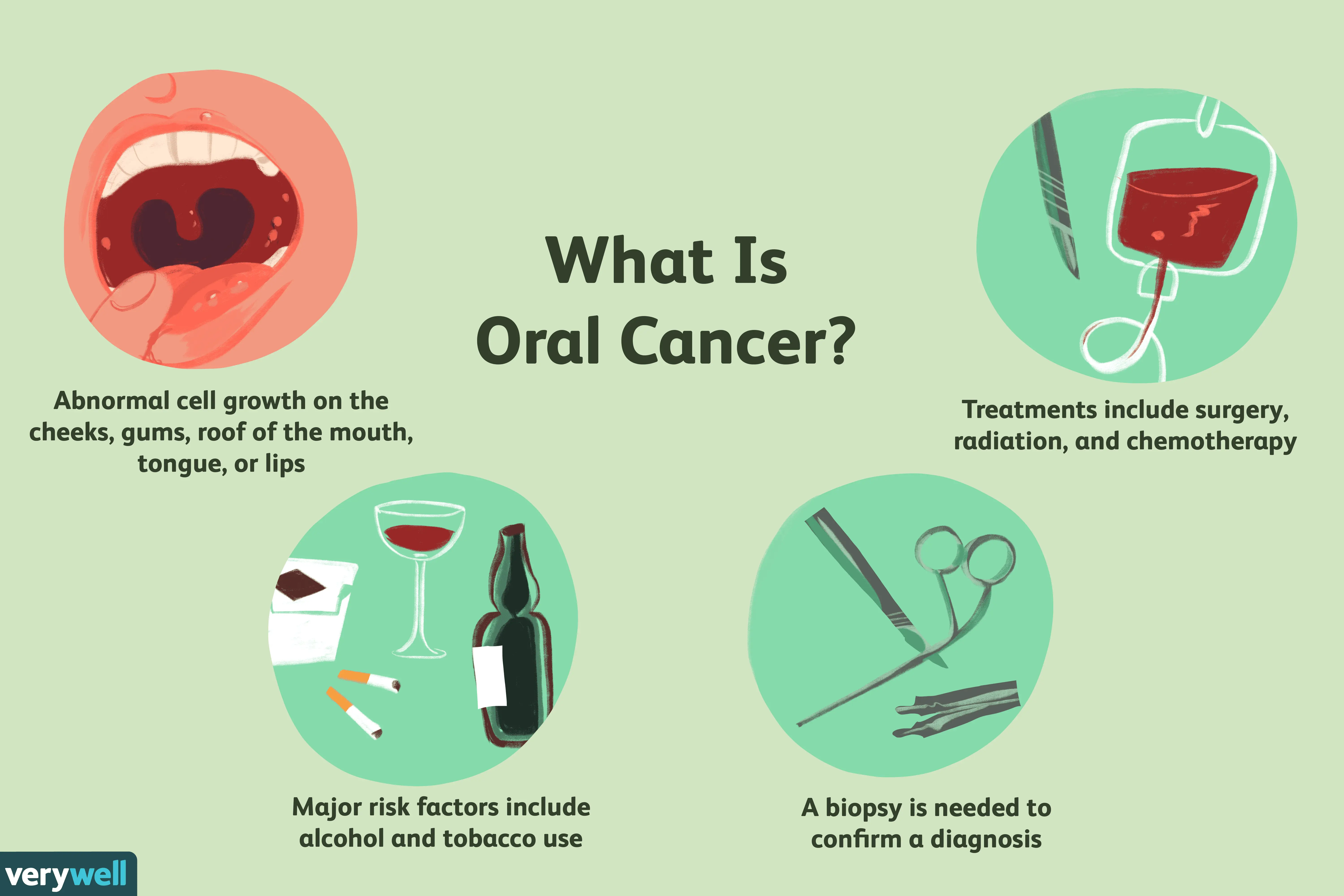 Oral cancer &#8211; causes, symptoms and treatment