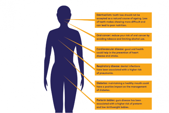 Oral diseases can lead to diabetes and heart attacks. How to prevent it?