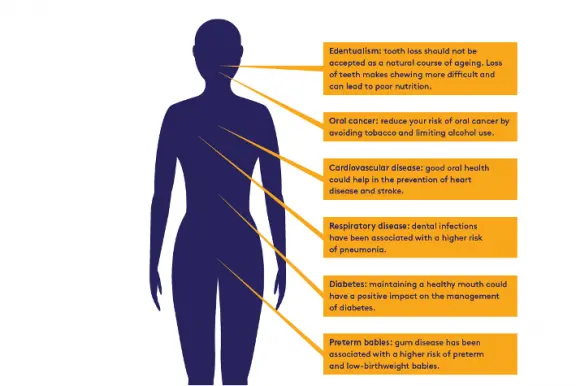 Oral diseases can lead to diabetes and heart attacks. How to prevent it?