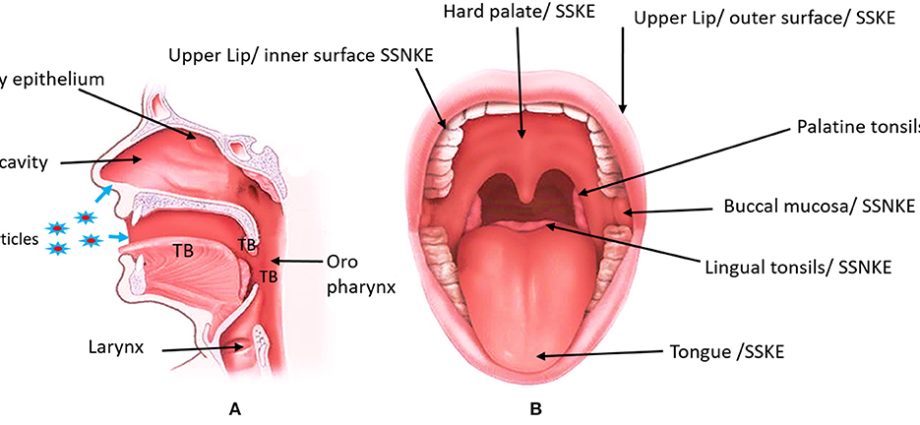 Oral mucosa lesions due to allergies &#8211; types, symptoms, treatment