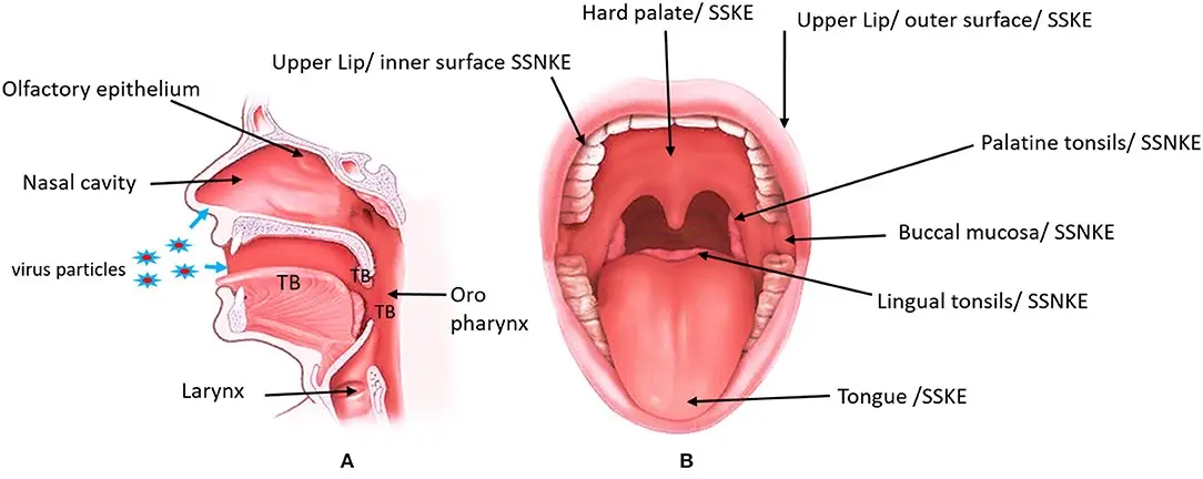 Oral mucosa lesions due to allergies &#8211; types, symptoms, treatment