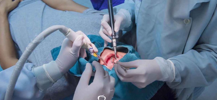 Oral surgery &#8211; what does it do? When to visit the oral surgeon?