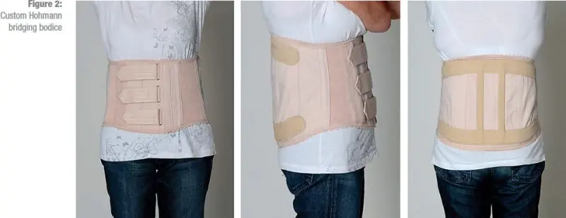 Orthopedic corset &#8211; indications, action, method of use, reimbursement