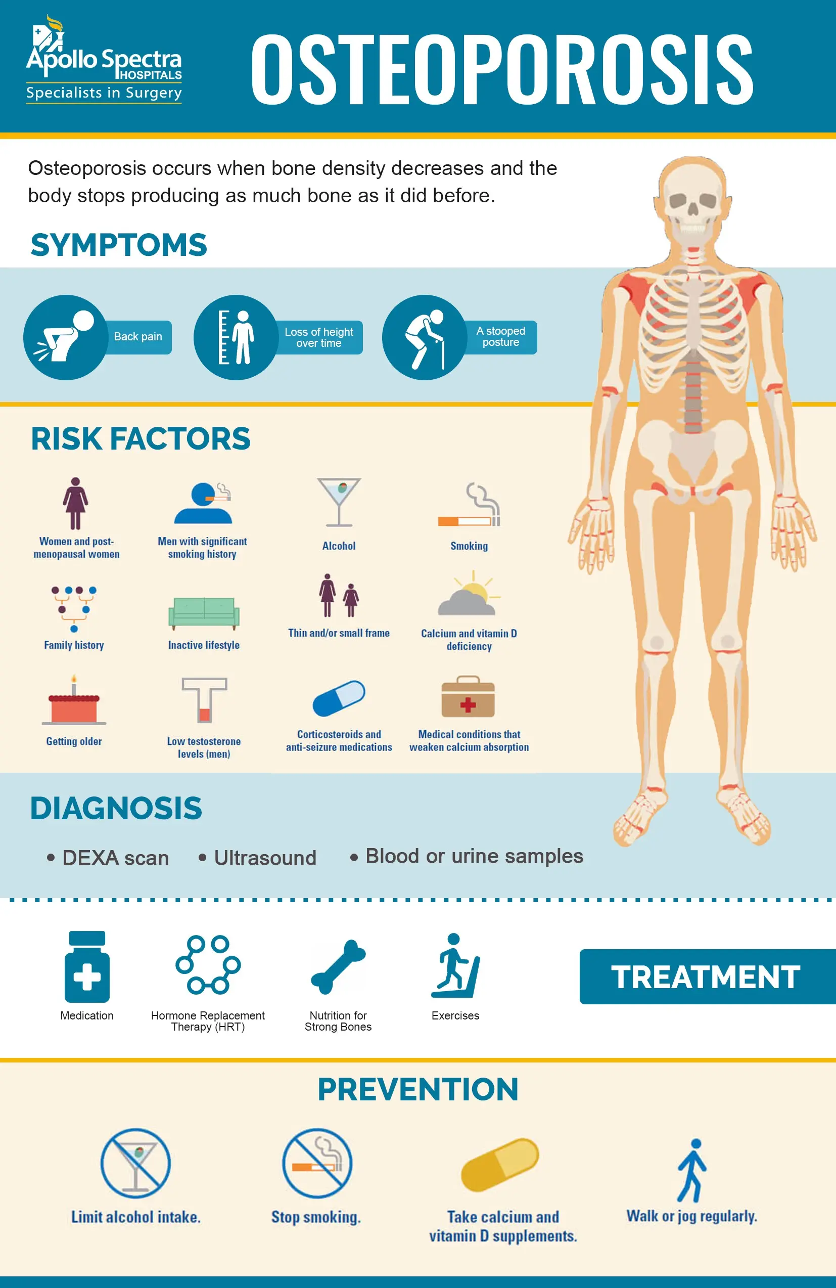 Osteoporosis &#8211; causes, treatment