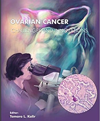 Ovarian cancer &#8211; a challenge for XNUMXst century medicine