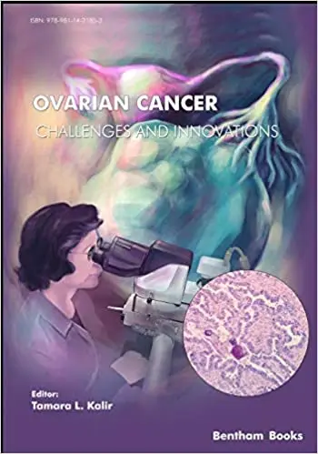 Ovarian cancer &#8211; a challenge for XNUMXst century medicine