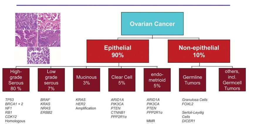 Ovarian cancer and gene mutations. What are the modern methods of treatment?