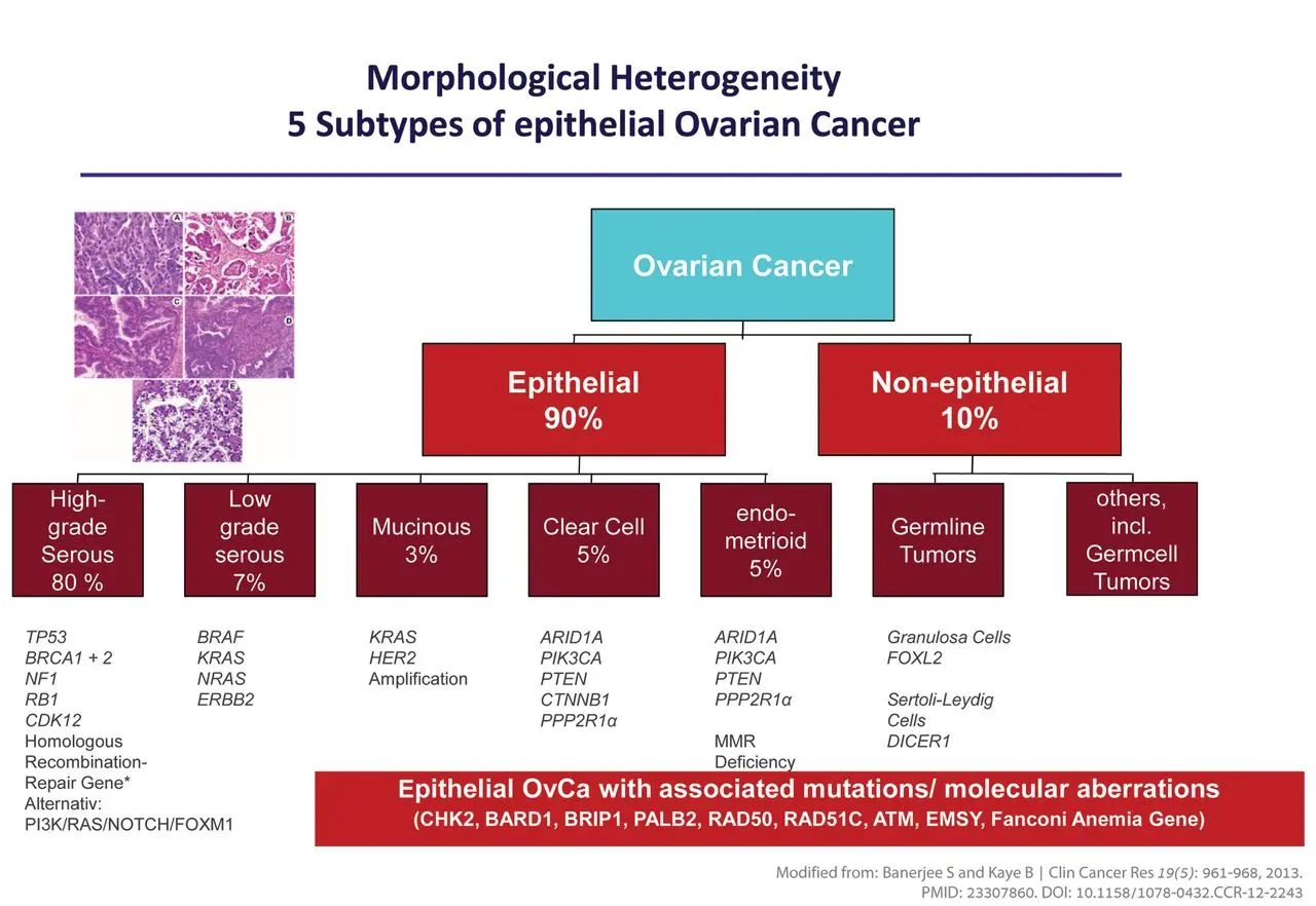 Ovarian cancer and gene mutations. What are the modern methods of treatment?