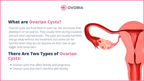 Ovarian Cyst in Pregnancy &#8211; When Does It Need to Be Treated?