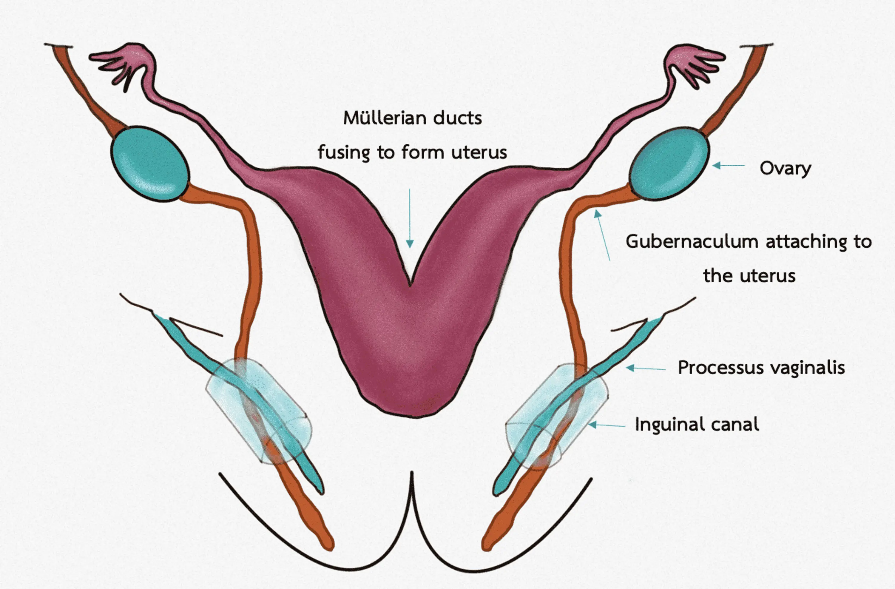 Ovarian hydrocele