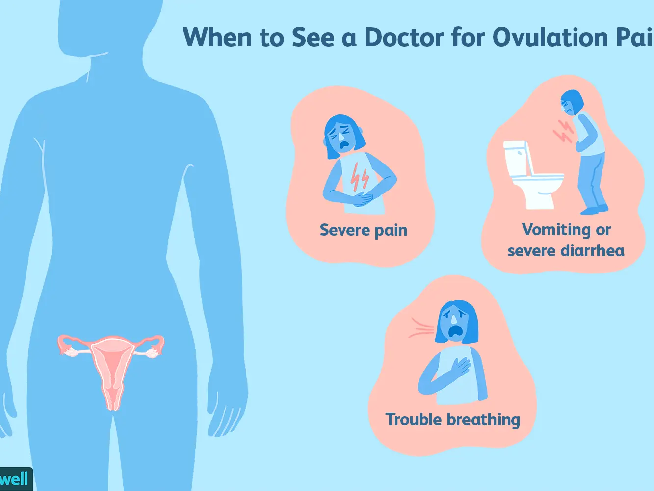 Ovarian pain after ovulation and ovulation pain &#8211; when does it occur and what does it mean?