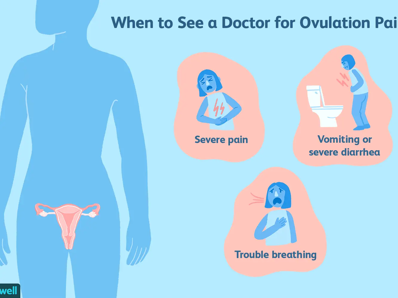 Ovulatory pain &#8211; when it occurs symptoms