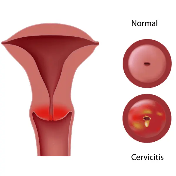 Pain during intercourse &#8211; what could be the causes?